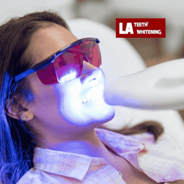 Contact LA Teeth Whitening Today! Book your appointment!Contact LA Teeth Whitening Today! Book your appointment! Daventry