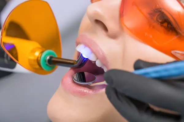 How Long Does Laser Teeth Whitening Last Daventry