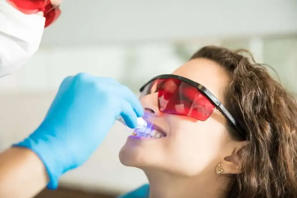 Laser Teeth Whitening FAQs Daventry &ndash; Your Ultimate Guide Daventry