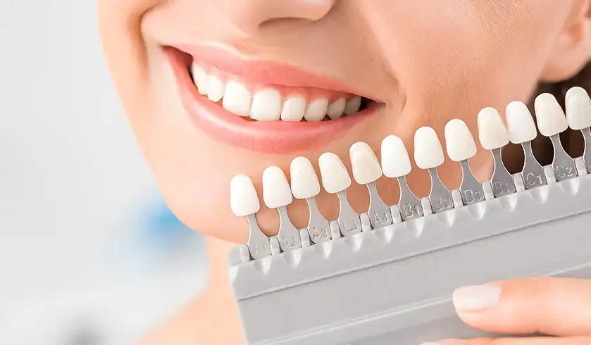 How Can You Tell When It&rsquo;s Time for a Touch-Up Daventry